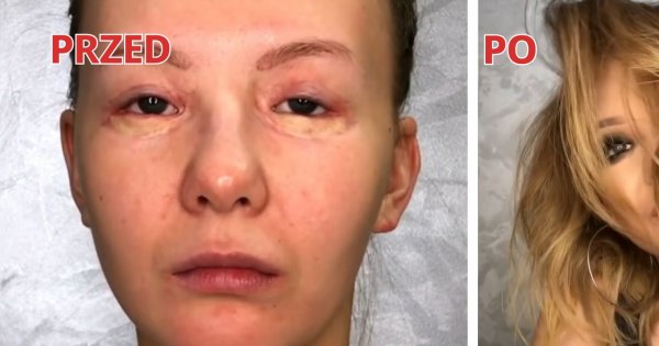 Szokująca metamorfoza kobiety po 15 operacjach oczu. Smoky eyes totalnie ją odmienił!