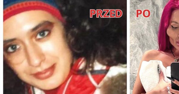 Anastasia ma największe policzki na świecie. "Kocham je", mówi. Bez wypełniaczy wyglądała jak inna osoba!