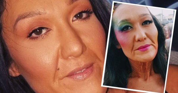31-latka ma skórę starszej osoby. Ludzie się z niej śmieją, a ona dumnie prezentuje swoje wdzięki