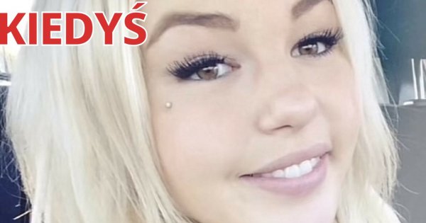 Ta kobieta wydała ponad milion złotych, by upodobnić się do... smoka! Zobacz, jak wygląda teraz!