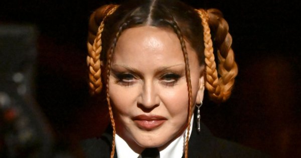Madonna straszyła nową twarzą! Teraz komentuje odmieniony wygląd: "Kłońcie się w pas, s*ki!"
