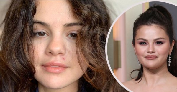 Selena Gomez ostro reaguje na komentarze dotyczące jej wagi. "Wolę być zdrowa"