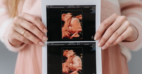 "Jestem po 40-stce i jestem w ciąży. Teściowa krytykuje mnie za moją decyzję i jej nie rozumie"