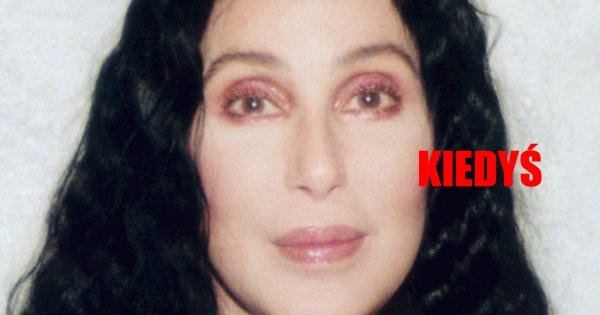 Cher zaczyna coraz bardziej przypominać Michaela Jacksona? Jej twarz wygląda niepokojąco!