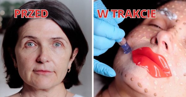 "Mój o 5 lat młodszy mąż zabronił mi się starzeć. Pewna wiadomość zwaliła mnie z nóg. Przeszłam sporą metamorfozę"