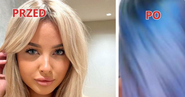22-letnia Oliwia z "Love Island" ma nowe zęby i niebieskie włosy! Zdradziła, ile za to zapłaciła