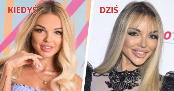 Alicja Kolasińska z "Love Island" trochę się zmieniła! Na gali Osobowości i Sukcesy Roku zaszokowała metamorfozą