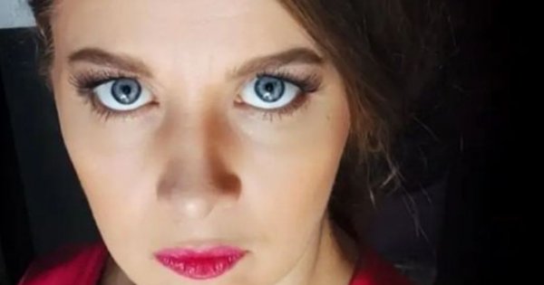 Anna Powierza z siniakami po zabiegach upiększających. Ktoś pisze: "Sporo bólu w tych oczach"