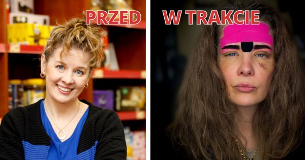 Anna Powierza po zabiegu usunięciu fałdu skórnego z powiek. Jej twarz wygląda jak nowa?