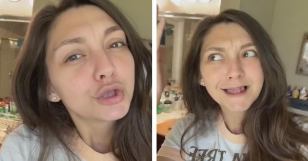 Dentysta sadysta wyrwał jej wszystkie zęby. Teraz 31-letnia kobieta podbija TikToka!