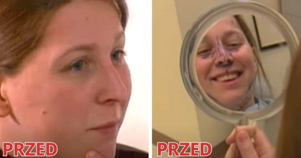 Pamiętacie program "Łabędziem być"? Przypominamy najbardziej spektakularną metamorfozę!