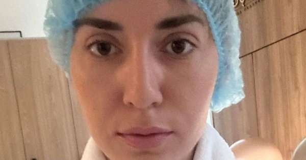 Marianna Schreiber pokazała przerażające zdjęcia po operacji nosa. Po zdjęciu opatrunków wszystko jest opuchnięte