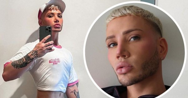 Żywy Ken z pośladkami Kim Kardashian! Na swoją metamorfozę wydał już ponad 400 000 złotych!