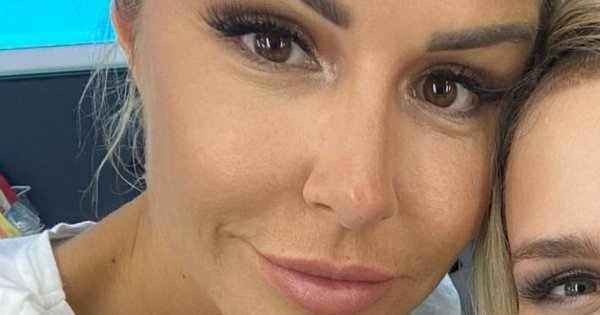 Blanka Lipińska pokazała, jak wyglądała przed powiększeniem ust: "Tak, górnej wargi nie mam wcale"