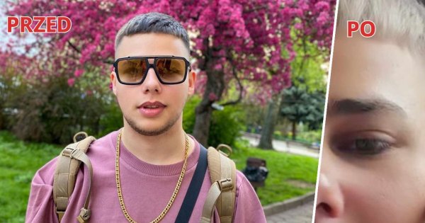 Allan Krupa zmienił fryzurę. Jest blondynem! Jednak cięcie wyszło niekorzystnie...