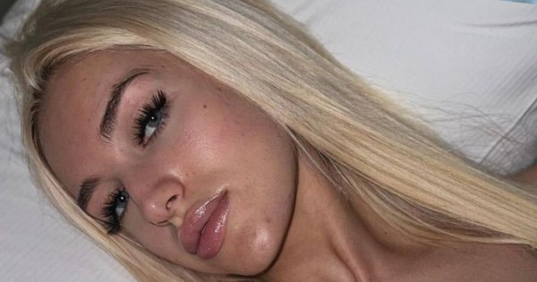 Nieznane fakty o Caroline Derpieński! Znany lekarz rzucił nowe światło na to, jaka naprawdę jest kontrowersyjna modelka