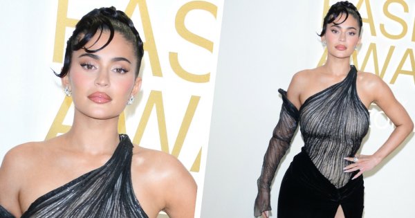 Kylie Jenner ujawniła nagą prawdę na temat operacji plastycznych. Ale wyznanie! Spodziewaliście się?