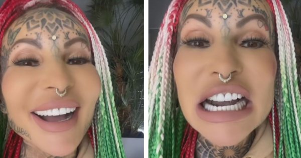 Ile Adrianna Eisenbach z "Królowych życia" zapłaciła za nowe zęby? Zdradziła konkretną cenę