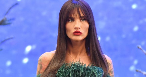 Karolina Gilon majstrowała coś przy twarzy? W końcu zdobyła się na wyznanie. Dobrze, że o tym mówi!