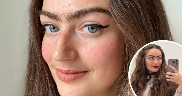 Eldina Jaganjac nie depiluje monobrwi ani wąsika! Ma w tym jeden cel... Czy naturalność może być piękna?