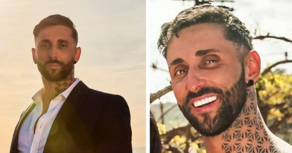 Jak Dan Kowalski z "Love Island 9" wyglądał z prawdziwymi zębami? Porównujemy stare zdjęcia!