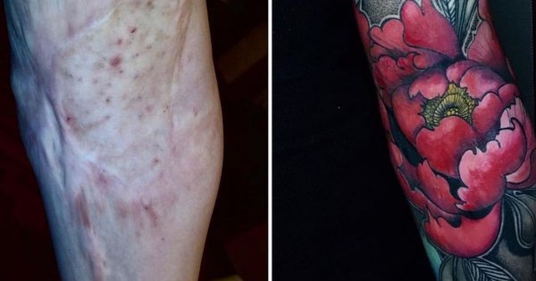 Tatuaże na bliznach - przykryją skazy i ukażą piękno wzoru. Pokazujemy niesamowite metamorfozy