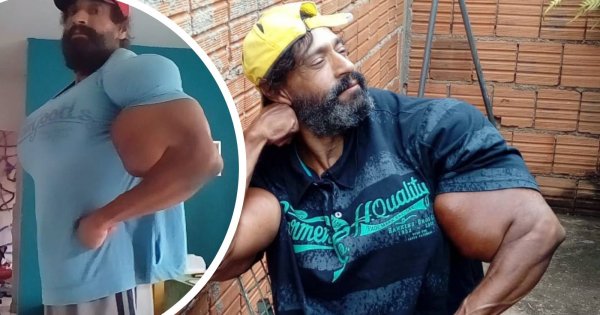 Brazylijczyk chciał upodobnić się do Hulka. Zmarł w dniu swoich 55. urodzin. Jego organizm nie wytrzymał