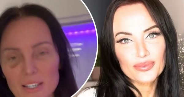 Monika Laskowska pokazała się bez makijażu i z podbitym okiem. Wyjaśniła fanom, że to efekt treningów