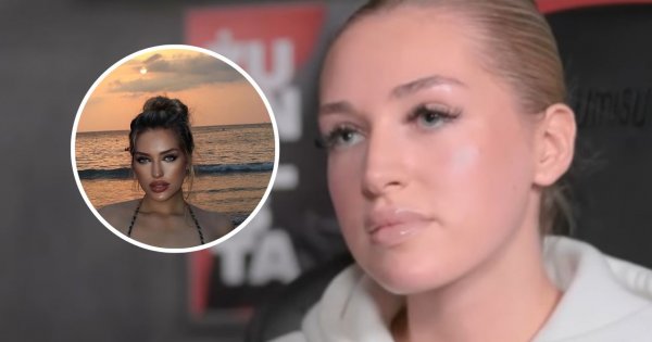 Caroline Derpieński pręży się na plaży w zwierzęcym stroju kąpielowym. Jest nie do poznania - ktoś tu lekko przesadził z przeróbkami