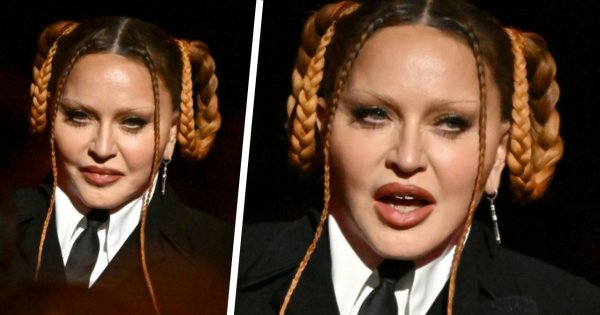 Madonna już tak nie wygląda. Zakonserwowana 66-latka pokazała swoją nową "wyprasowaną" twarz, a zachwytom nie było końca