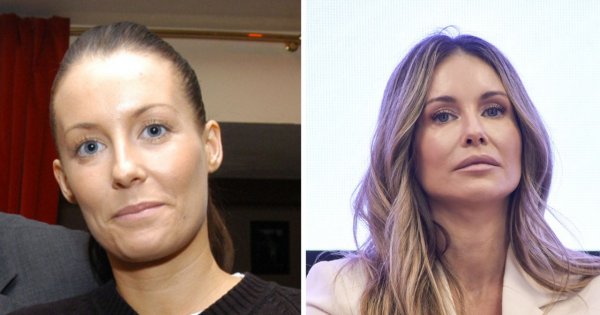Małgorzata Rozenek zaliczyła mega przemianę. Z naturalnej pani prawnik w podrasowaną celebrytkę [porównujemy]