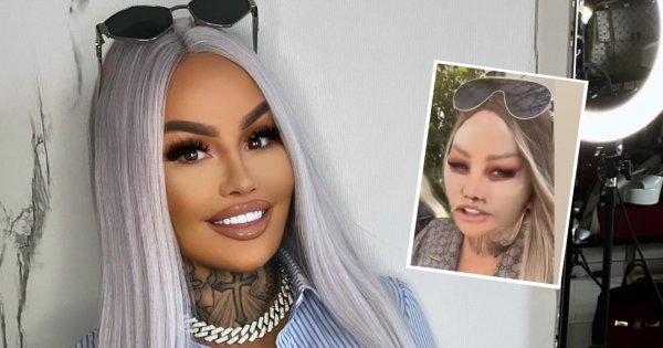 Laluna Unique pokazała rezultaty operacji. Kocie oczy i Barbie baby face odmłodziły ją o 20 lat