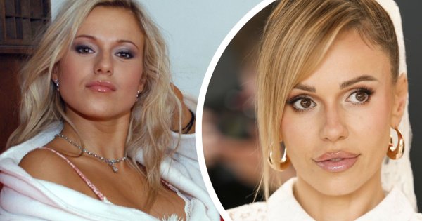 Ekspert ocenił twarz Dody: "Zaraz zacznie się sypać". Sprawdzamy, czy to już [porównanie zdjęć]