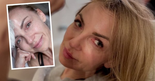 Anna Wyszkoni przerywa milczenie po dramatycznym wypadku. "Zaczęła się walka o życie"
