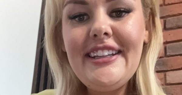 Kinga Zawodnik pokazała brzuch po zrzuceniu 60 kilosów. Tego nie widać pod filtrami