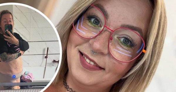 Mama na obrotach pokazała brzuch po zrzuceniu 35 kilosów. "Nadmiar skóry zawsze można wyciąć"