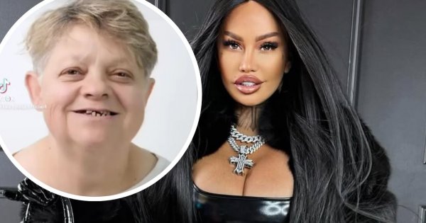 Mama Laluny ma nowe zęby z Turcji. Ludzie nie wierzą