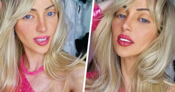 "Nieludzka Lalka" nie żyje. Ostatnie słowa 31-latki, która chciała wyglądać jak Barbie, mrożą krew w żyłach