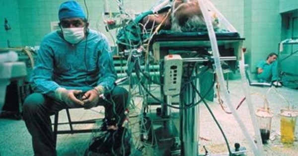 40 lat temu Religa dokonał niemożliwego. A potem zasnął na krześle ze zmęczenia
