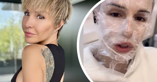 Blanka Lipińska pokazała się po zabiegu. Twarz spuchnięta, ledwo widzi
