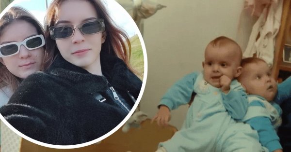 Polskie bliźniaczki syjamskie zmieniły się nie do poznania. Tak dziś wyglądają. Niewiarygodne, czym zajmują się na co dzień [dużo zdjęć]