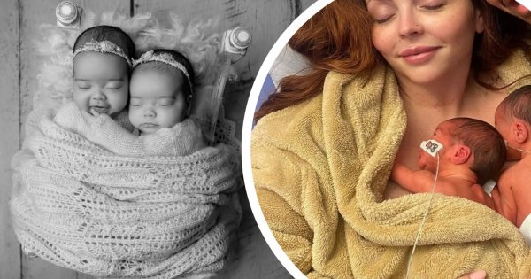Mówili jej, że to typowe dla wcześniaków. Diagnoza córek gwiazdy łamie serce
