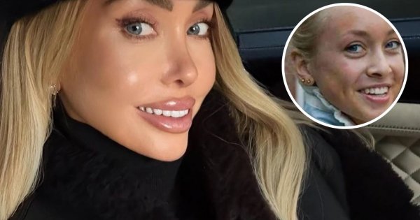 Biegała po plaży w dresie, dziś żyje w pałacu miliardera. Julia Dybowska na starych zdjęciach jest nie do poznania [porównujemy zdjęcia]