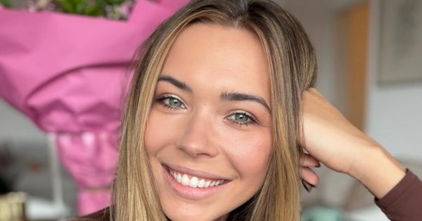 Sandra Kubicka zdjęła szwy z twarzy. Pochwaliła się wyglądem i wyznała szczerze: "Jak dzwonnik z Notre Dame" [zdjęcie]