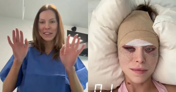 Julia von Stein zapuchnięta i obolała modli się o cud. Fani śledzą relację celebrytki z kliniki [zdjęcia]