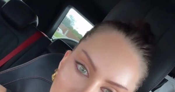 Julia von Stein pokazała nową twarz po liftingu. Szczęka opada: w lustrze widziała obcą osobę [zdjęcie]