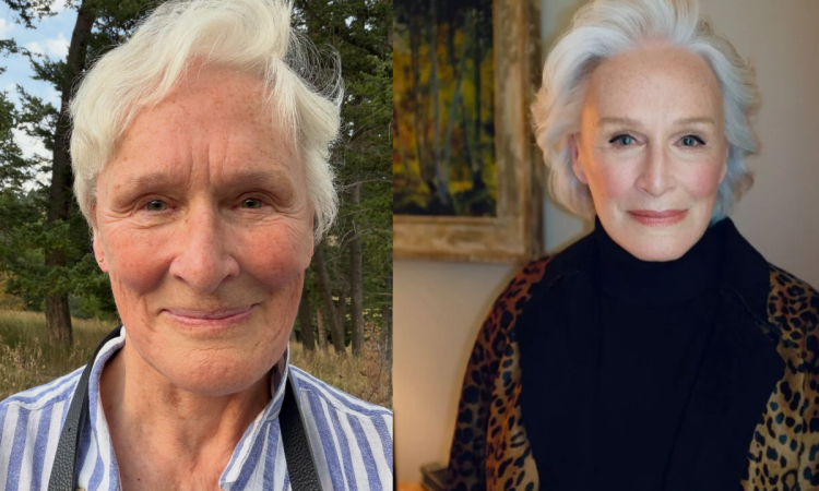 Glenn Close z laską po operacji biodra. "Moje lewe biodro było w naprawdę kiepskim stanie"