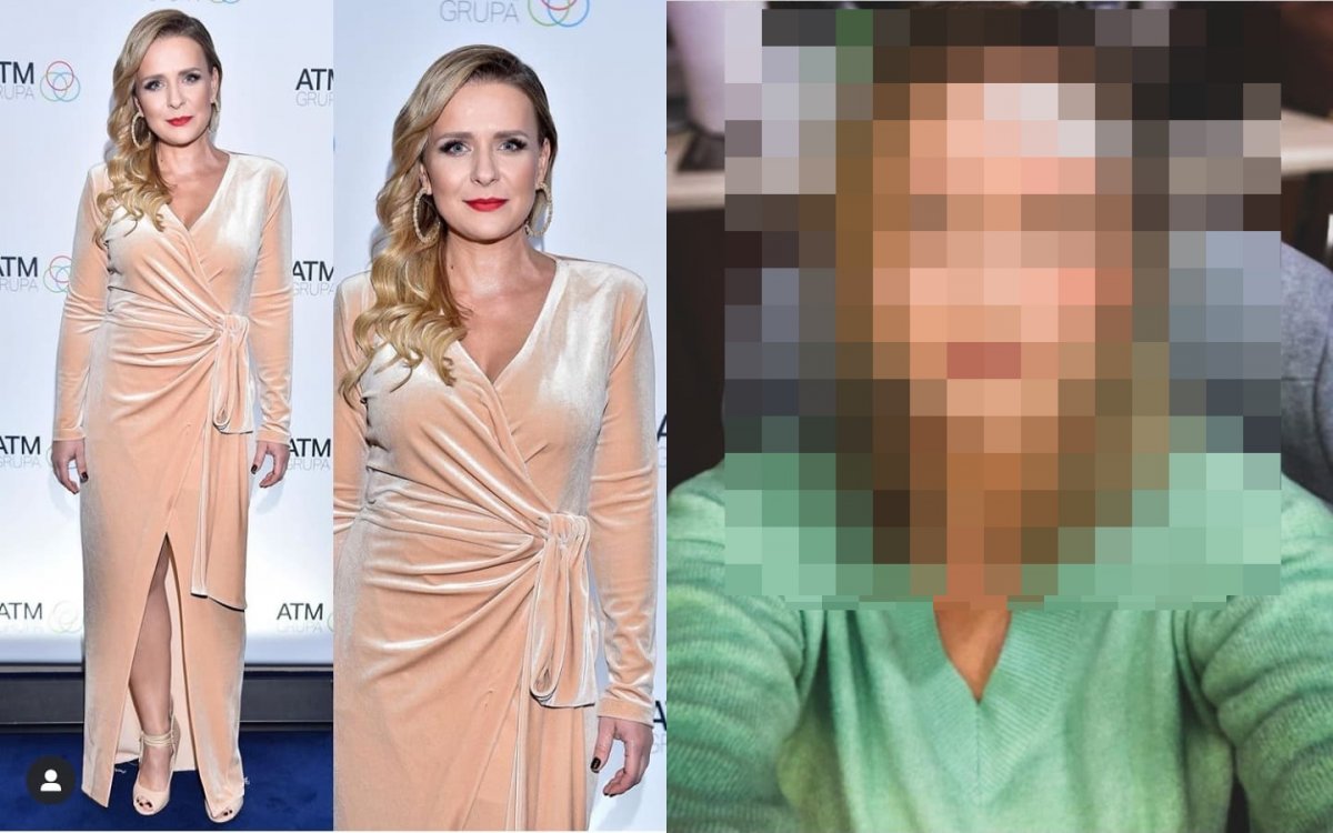 Posiniaczona Aneta Zając opublikowała drastyczne zdjęcia. Co się stało? Jak do tego doszło? Wyznała prawdę!