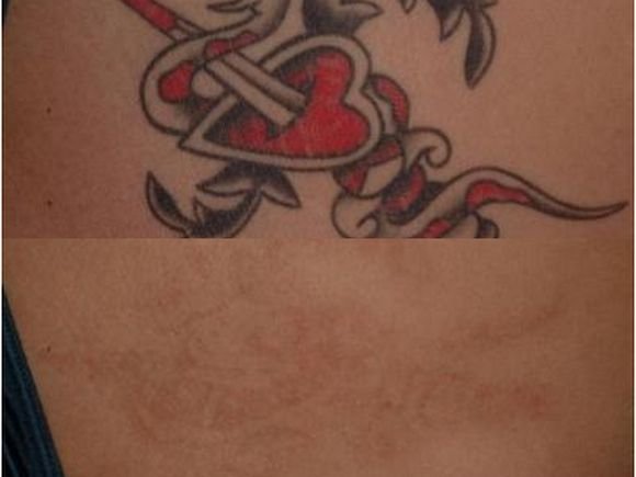 tatuaz
