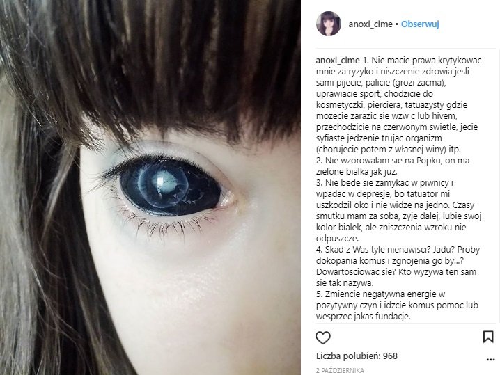 Fanka Popka, która straciła wzrok przez tatuaż oczu oskarża tatuażystę ...